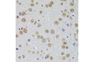 Immunohistochemistry of paraffin-embedded mouse brain using DMAP1 antibody. (DMAP1 antibody)