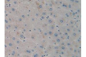 IHC-P analysis of Human Liver Tissue, with DAB staining. (CXCL12 antibody)