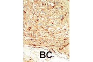 Immunohistochemistry (IHC) image for anti-Macrophage Stimulating 1 (Hepatocyte Growth Factor-Like) (MST1) antibody (ABIN3003576) (MST1 antibody)