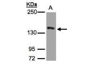 WB Image Sample(30 ug whole cell lysate) A:HeLa S3, 5% SDS PAGE antibody diluted at 1:1000 (c-MET antibody  (C-Term))