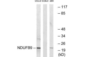 Western Blotting (WB) image for anti-NADH Dehydrogenase (Ubiquinone) 1 beta Subcomplex, 9, 22kDa (NDUFB9) (Internal Region) antibody (ABIN1851644) (NDUFB9 antibody  (Internal Region))