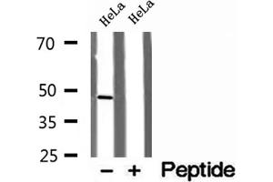 Western blot analysis of extracts of HeLa cells, using RNH1 antibody. (RNH1 antibody  (Internal Region))