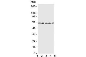 Western blot testing of CYP2U1 antibody and Lane 1:  HeLa;  2: MCF-7;  3: MM453;  4: COLO320;  5: HT1080 cell lysate (CYP2U1 antibody  (C-Term))