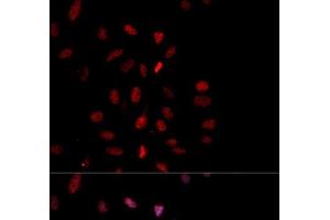 Immunofluorescence analysis of MCF-7 cells using Phospho-c-Fos(T232) Polyclonal Antibody (c-FOS antibody  (pThr232))