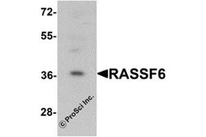 Western Blotting (WB) image for anti-Ras Association Domain-Containing Protein 6 (RASSF6) (Middle Region) antibody (ABIN1031054) (RASSF6 antibody  (Middle Region))