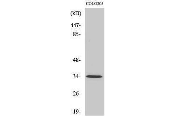 OR5P3 antibody  (Internal Region)