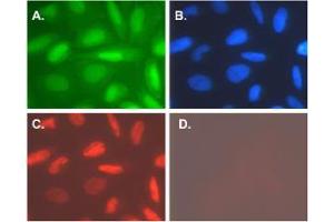 Immunofluorescence (IF) image for anti-Telomerase Reverse Transcriptase (TERT) (C-Term) antibody (ABIN6655270)