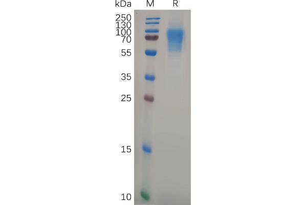 CD6 Protein (CD6) (AA 18-398) (His tag)