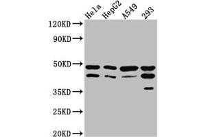 Western Blot Positive WB detected in: Hela whole cell lysate, HepG2 whole cell lysate, A549 whole cell lysate, 293 whole cell lysate All lanes: GSK3 beta Antibody at 1:1000 Secondary Goat polyclonal to rabbit IgG at 1/50000 dilution Predicted band size: 47, 49 kDa Observed band size: 47 kDa (Recombinant GSK3 beta antibody)