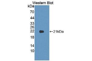 Western blot analysis of the recombinant protein. (LAMa4 antibody  (AA 457-630))