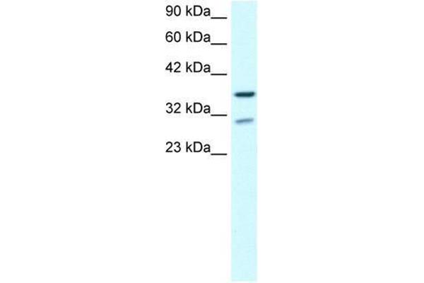 ZNF385A 抗体  (N-Term)