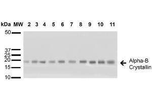 Western blot analysis of Human A431, HCT116, HeLa, HepG2, HEK293, HUVEC, Jurkat, MCF7, PC3 and T98G cell lysates showing detection of ~22 kDa Alpha B Crystallin protein using Rabbit Anti-Alpha B Crystallin Polyclonal Antibody . (CRYAB antibody  (Atto 594))