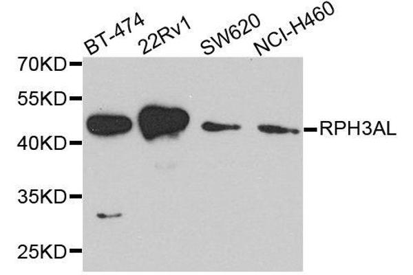 RPH3AL antibody  (AA 161-315)