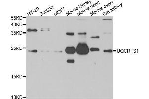 Western blot analysis of extracts of various cell lines, using UQCRFS1 antibody (ABIN5974112) at 1/1000 dilution. (UQCRFS1 antibody)