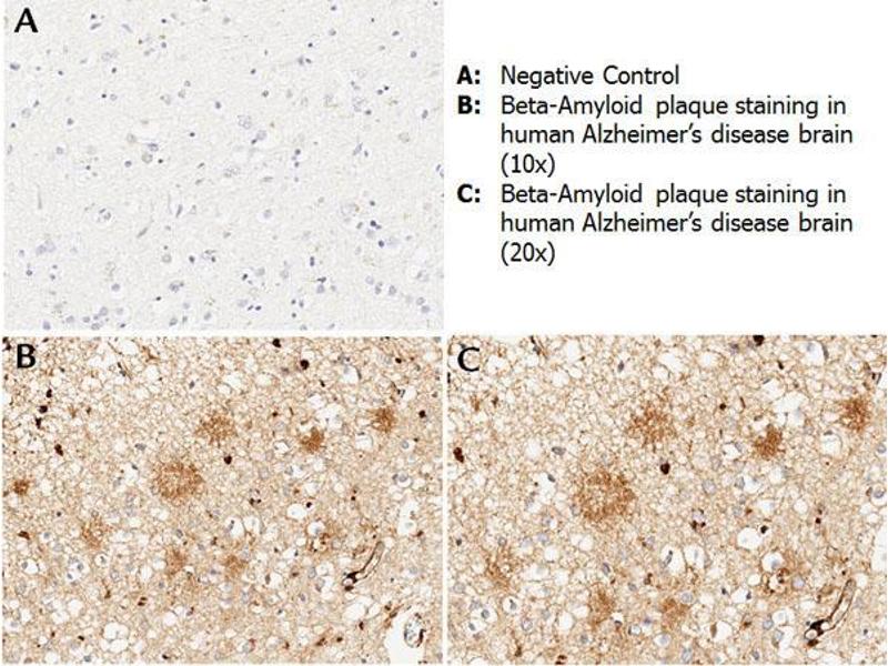 beta Amyloid Antibody (ABIN95037)