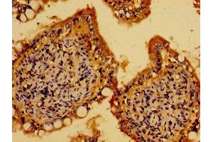 Immunohistochemistry of paraffin-embedded human small intestine tissue using ABIN7143505 at dilution of 1:100 (ARL4C antibody  (AA 2-192))