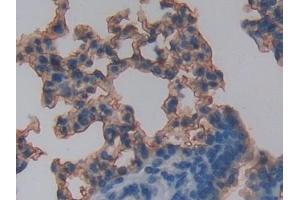 DAB staining on IHC-P; Samples: Mouse Lung Tissue (RAGE antibody  (AA 10-188))