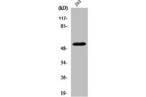 Western Blot analysis of 293 cells using Cleaved-MMP-14 (Y112) Polyclonal Antibody (MMP14 antibody  (Cleaved-Tyr112))
