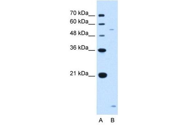 ST3GAL5 antibody  (N-Term)