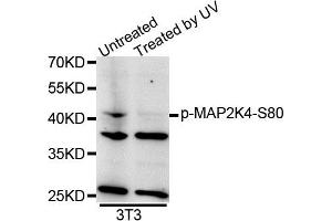Western blot analysis of extracts of NIH-3T3 cell line, using Phospho-MAP2K4-S80 antibody. (MAP2K4 antibody  (pSer80))