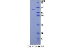 SDS-PAGE (SDS) image for Calcineurin-Like phosphoesterase Domain Containing 1 (Cpped1) (AA 1-312) protein (His tag) (ABIN6239540) (Cpped1 Protein (AA 1-312) (His tag))