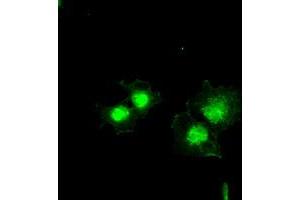 Anti-BCL2L1 mouse monoclonal antibody (ABIN2452380) immunofluorescent staining of COS7 cells transiently transfected by pCMV6-ENTRY BCL2L1 (RC201314). (BCL2L1 antibody  (AA 1-212))