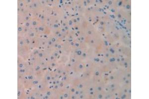 IHC-P analysis of Human Tissue, with DAB staining. (PCK1 antibody  (AA 311-558))