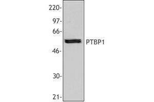 Western Blotting (WB) image for anti-Polypyrimidine Tract Binding Protein 1 (PTBP1) antibody (ABIN2665344) (PTBP1 antibody)