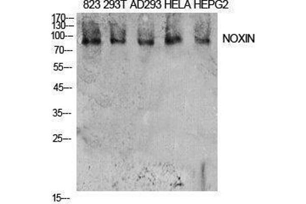 C11orf82 antibody  (Internal Region)