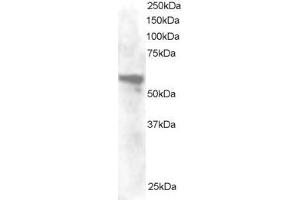 Western Blotting (WB) image for anti-Annexin A11 (ANXA11) (N-Term) antibody (ABIN2465169) (Annexin A11 antibody  (N-Term))