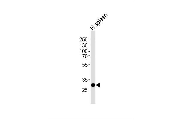 SAP30 antibody  (C-Term)