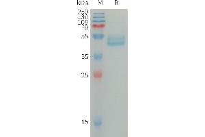 Human IL4 Protein, mFc Tag on SDS-PAGE under reducing condition. (IL-4 Protein (AA 25-153) (mFc Tag))