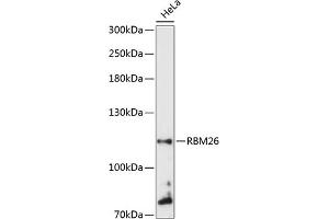 Western blot analysis of extracts of HeLa cells, using RBM26 antibody  at 1:3000 dilution. (RBM26 anticorps  (AA 65-140))