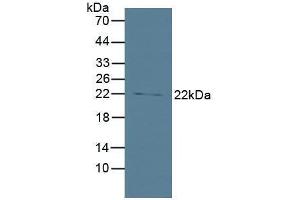 Western blot analysis of Human Lung Tissue. (BID antibody  (AA 1-195))