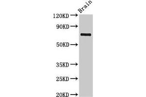 Western Blot Positive WB detected in: Rat brain tissue All lanes: L3MBTL4 antibody at 3 μg/mL Secondary Goat polyclonal to rabbit IgG at 1/50000 dilution Predicted band size: 72, 62 kDa Observed band size: 72 kDa (L3MBTL4 antibody  (AA 1-270))
