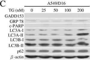 Western Blotting (WB) image for anti-Sequestosome 1 (SQSTM1) antibody (ABIN2854836)