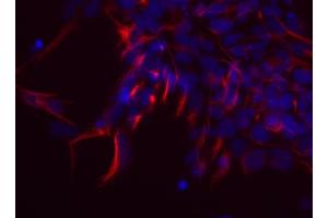 Immunocytochemistry (ICC) image for anti-Nestin (NES) antibody (ABIN1742563) (Nestin antibody)