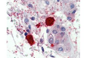 Anti-Mast Cell Chymase antibody IHC of human testis, mast cells. (CMA1 antibody  (AA 96-110))