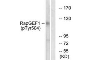 Western blot analysis of extracts from HepG2 cells treated with Na3VO4 0. (GRF2 antibody  (pTyr504))