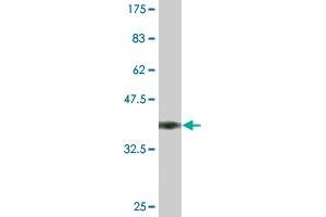 Western Blot detection against Immunogen (36. (ENOS antibody  (AA 61-160))