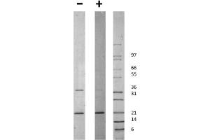 SDS-PAGE of Human globular ACRP-30 Recombinant Protein SDS-PAGE of Human globular ACRP-30 Recombinant Protein. (ADIPOQ Protein)