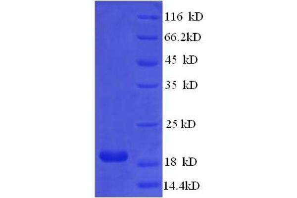 IFNA21 Protein (AA 24-189) (His tag)