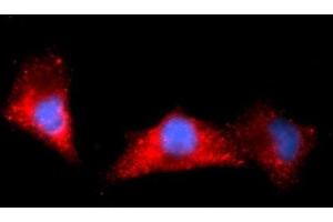 Immunofluorescence (IF) image for anti-Aldehyde Dehydrogenase 1 Family, Member A1 (ALDH1A1) (AA 1-501) antibody (APC) (ABIN5568626) (ALDH1A1 antibody  (AA 1-501) (APC))