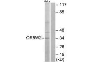 Western Blotting (WB) image for anti-Olfactory Receptor, Family 5, Subfamily W, Member 2 (OR5W2) (AA 158-207) antibody (ABIN2891038) (OR5W2 antibody  (AA 158-207))