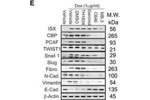 Western Blotting (WB) image for anti-Vimentin (VIM) antibody (ABIN2854814)