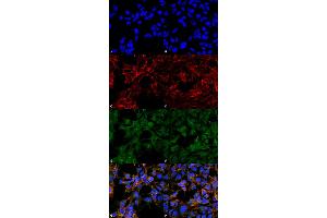 Immunocytochemistry/Immunofluorescence analysis using Mouse Anti-Malondialdehyde Monoclonal Antibody, Clone 6H6 . (Malondialdehyde antibody  (FITC))