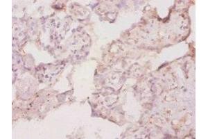 Immunohistochemistry of paraffin-embedded human placenta tissue using ABIN7177414 at dilution of 1:20 (M-CSF/CSF1 antibody  (AA 33-262))