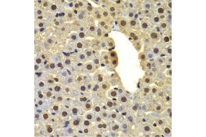 Immunohistochemistry of paraffin-embedded mouse liver using DTX2 antibody (ABIN6127799, ABIN6139853, ABIN6139854 and ABIN6223266) at dilution of 1:100 (40x lens). (DTX2 antibody  (AA 1-280))