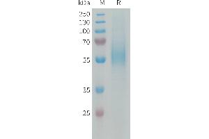 Human Protein, His Tag on SDS-PAGE under reducing condition. (Macrophage Scavenger Receptor 1 Protein (MSR1) (AA 77-451) (His tag))
