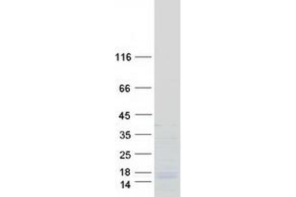 SFRS12IP1 Protein (Myc-DYKDDDDK Tag)